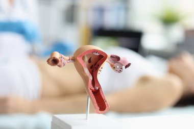 Some Of The Ways In Managing Endometriosis